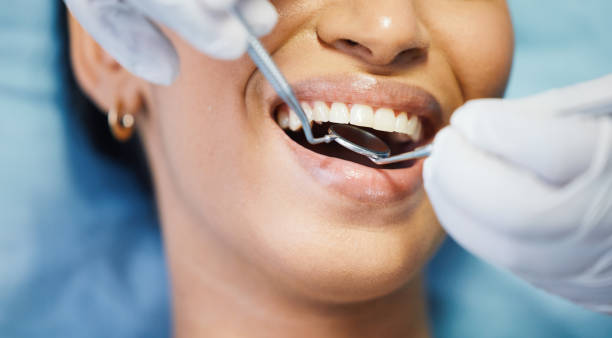 Best Emergency Treatment for Dental Infections or Abscesses in Rosemead, CA