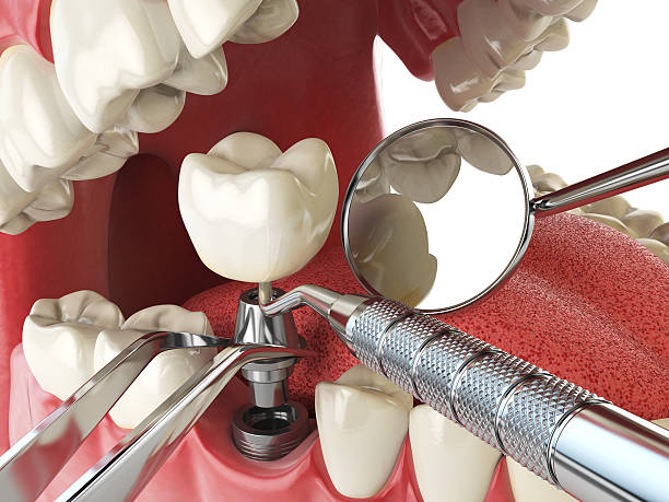 Best Cosmetic Emergency Dentistry in Rosemead, CA